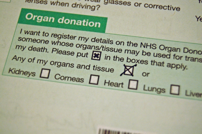 organ donation